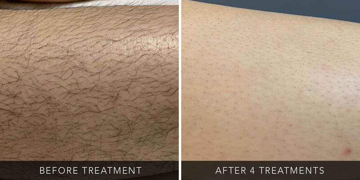 before-after-03