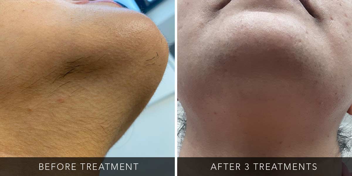 before-after-04