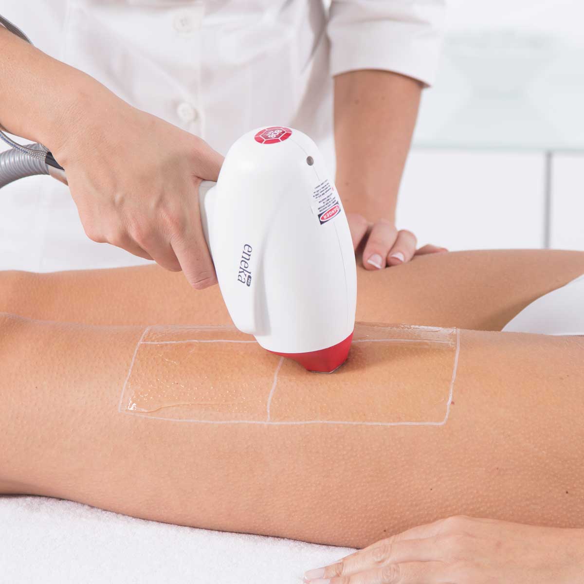 Laser-Hair-Removal-Treatment